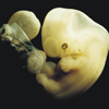 Эмбрион человека на 6 неделе беременности